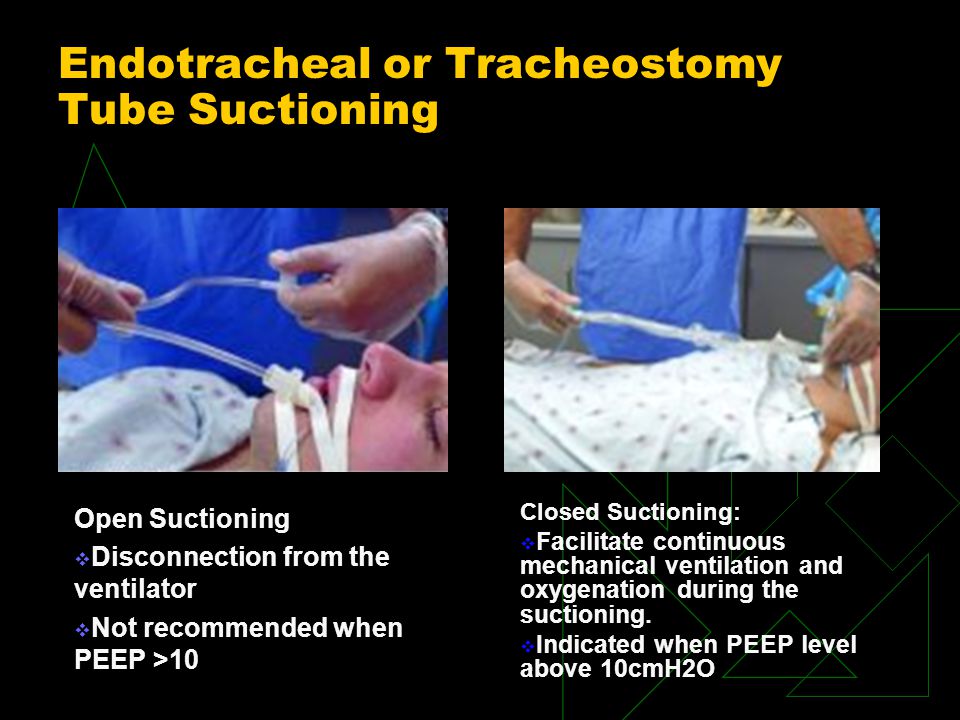 AIRWAY MANAGEMENT. ppt video online download